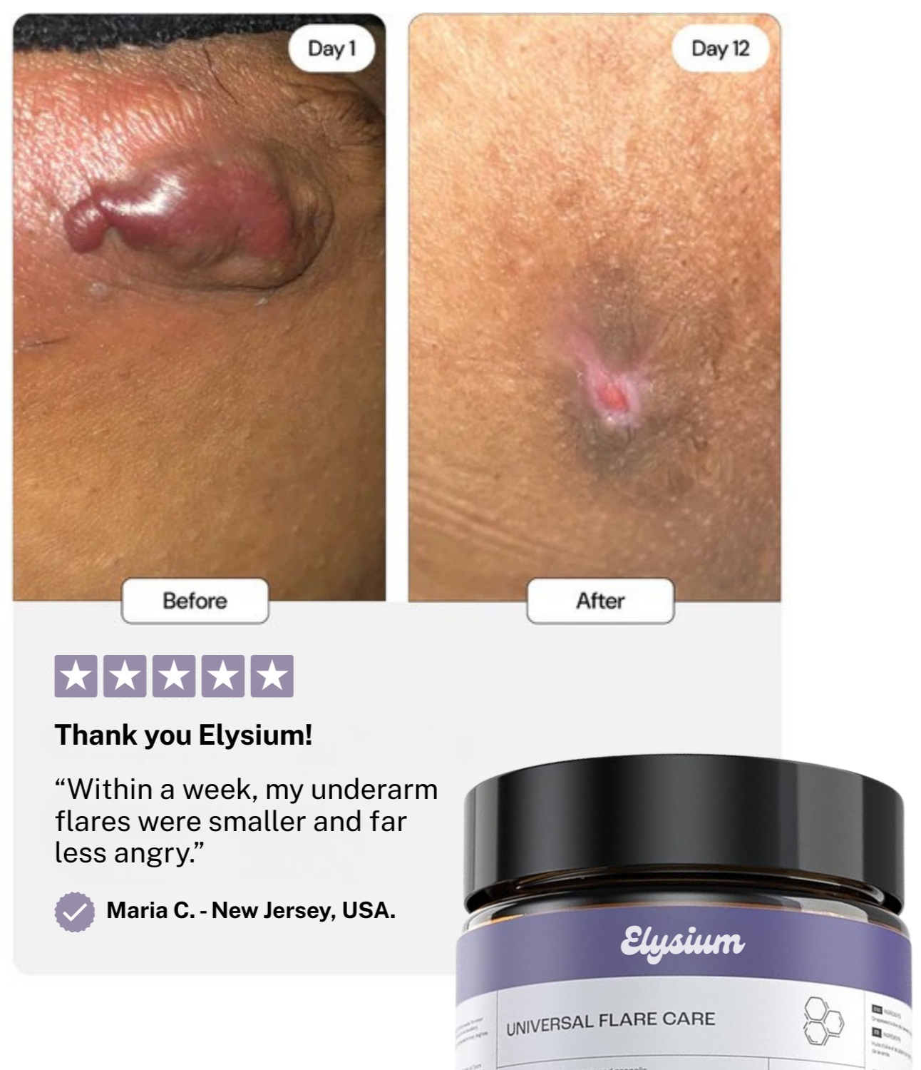 Elysium Flare Care