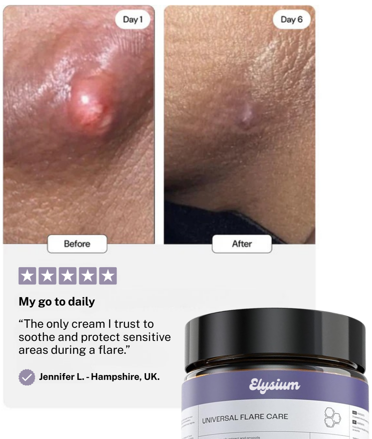 Elysium Flare Care