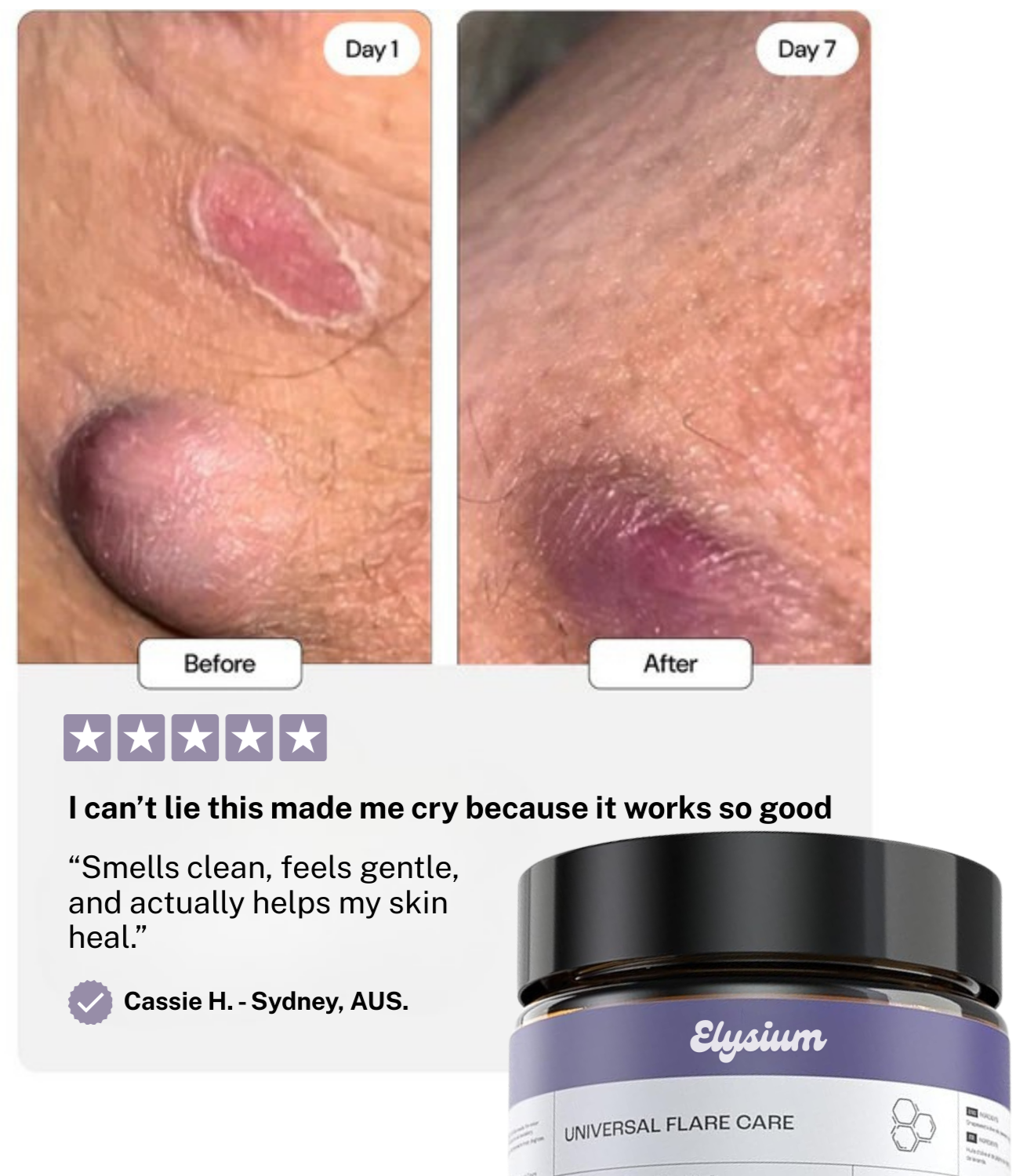 Elysium Flare Care