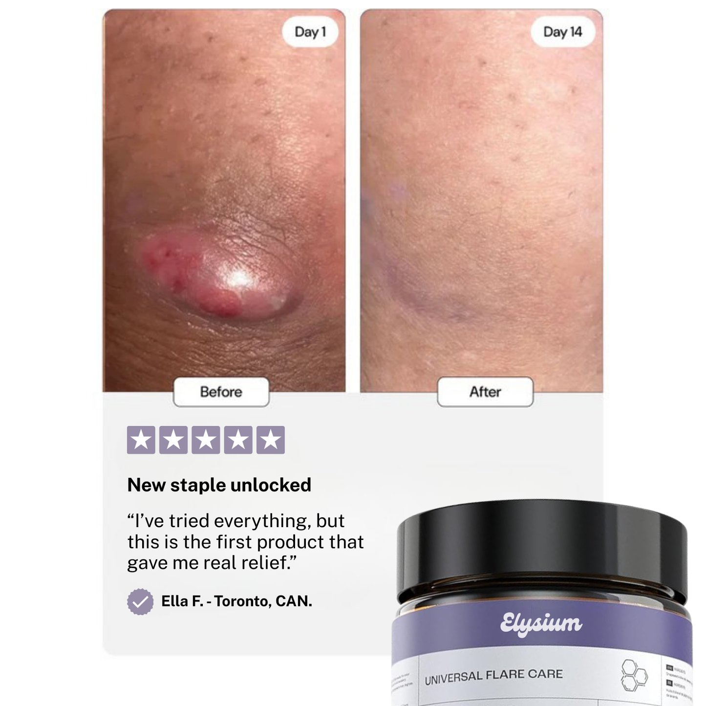 Elysium Flare Care