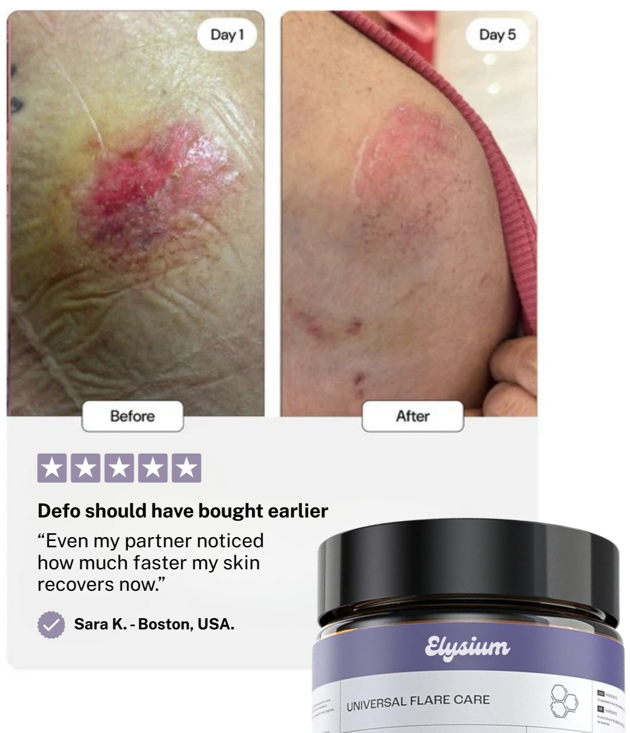 Elysium Flare Care